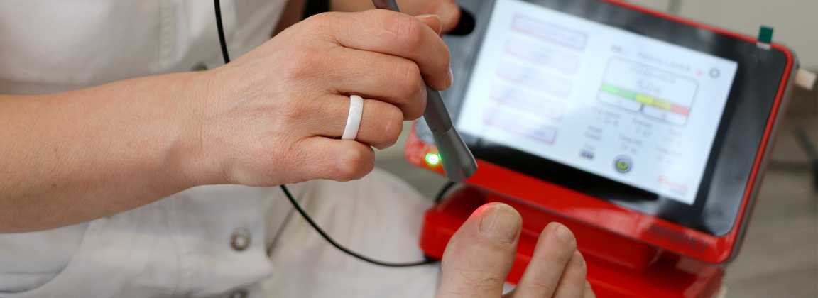 Zdjęcie przedstawiające zabieg podologiczny na wielkim palcu z wykorzystaniem laseru Rapido Podia który jest widoczny w tle